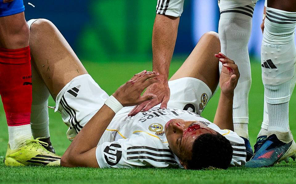 争议再起!姆巴佩受伤流血,主裁拒判点球,皇马官方强烈指责西甲暗箱操作 争议再起!姆巴佩受伤流血,主裁拒判点球,皇马官方强烈指责西甲暗箱操作